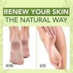 LANEMAY Tea Tree Oil Foot Cream for Dry, Cracked, and Rough Skin