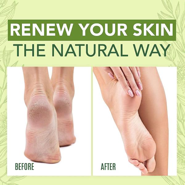 LANEMAY Tea Tree Oil Foot Cream for Dry, Cracked, and Rough Skin